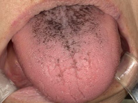 食紅ジュースを飲むと口に色が移りますか？ - パーティで青、赤、黄色、紫などの- Yahoo!知恵袋