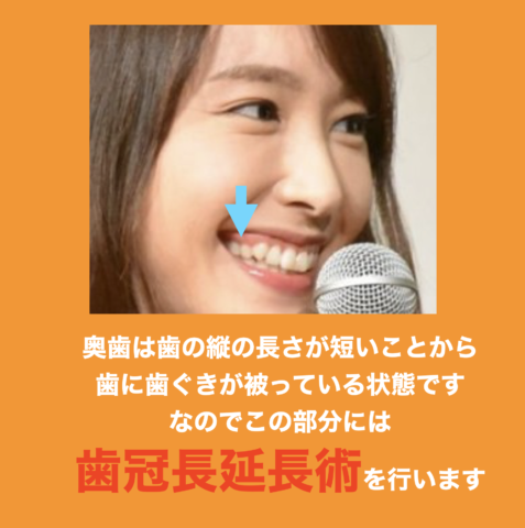 お値引き中☆クッキー柄☆矯正器具⭐︎部分入れ歯ケース☆赤ちゃんおしゃぶり入れ♡の通販 by machacha's shopラクマ