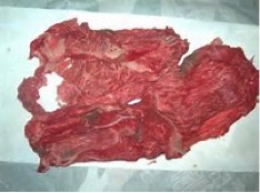 教えてください。豚肉の脂肪の中の黒い点々ゆるいブログ