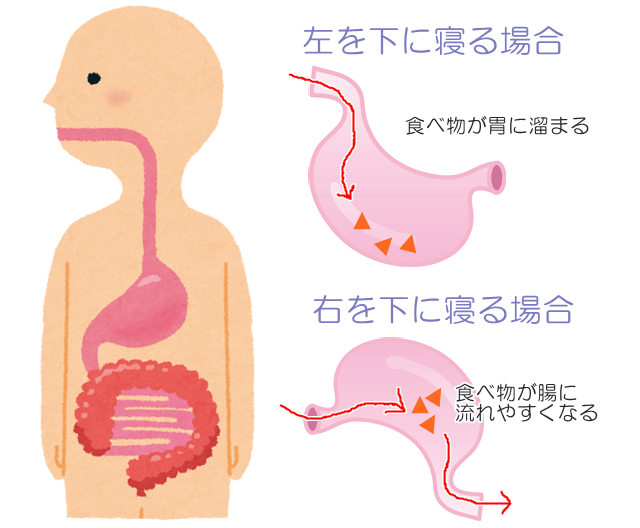 事例 「寝たまま食べさせてほしい」と頼まれたらへるぱる 訪問介護をサポートする情報誌