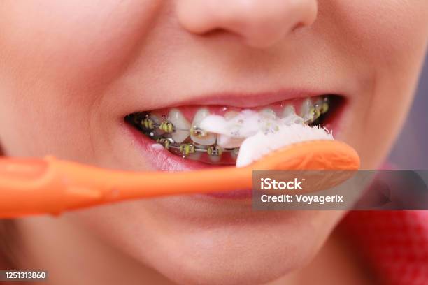 矯正中は何を食べたらいい？ 歯列矯正で痛みを感じる時、どんなものを食べればいいのか気になりますよね🤔おすすめの食べ物や、控えた方が良い食べ物をまとめました！ 矯正中でも、工夫をすれば食事を楽しめますよ🍚 ーーーーーーーーーーーーーーーーーーー🦷きずな